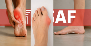 La fascitis plantar, los juanetes y el pie plano son algunas de las alteraciones del pie